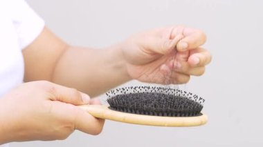 Saç dökülmesine stres ve genetik neden olur.