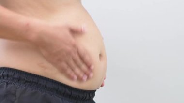 Koca göbekli ve aşırı yağlı obez adam diyetlerini kontrol etmeli..