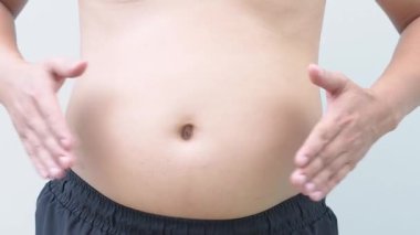 Koca göbekli ve aşırı yağlı obez adam diyetlerini kontrol etmeli..