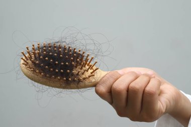 Saç dökülmüş, kuru ve kıvırcık saçlı bir kadın.