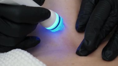 Kozmetik kliniğinde tanınmayan bir kadının boynu vakumla temizlenecek ve cilalanacak. Yakın plan. Cerrahi olmayan kozmetoloji cilt bakımı. Profesyonel nemlendirici ve gençleştirici donanım prosedürleri