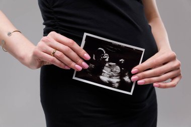 Huzurlu bir ifadeyle, bir anne bebeğini kucağına alır ve çok değerli bir ultrason görüntüsü verir. Bu an, ufuktaki yeni hayatın heyecanını ve beklentisini yakalıyor..