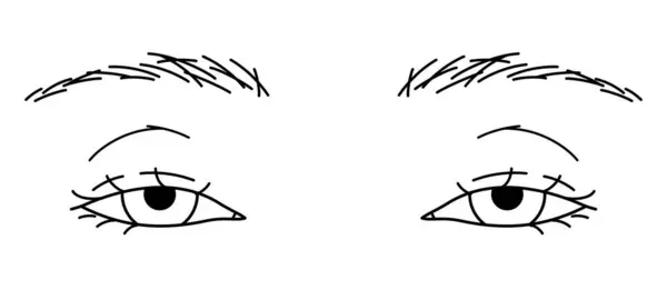 女性の目 ドロップするまぶた ポトーシス 概要のイラスト — ストックベクタ