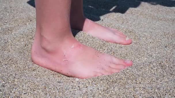子供の足に日焼け剥離を閉じます 日焼けの概念 太陽の下で焼かれた皮膚 損傷した皮膚 高品質の写真 — ストック動画