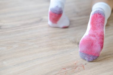 Beyaz çoraplara dökülen kirli meyve suyu lekeleri. Günlük yaşam lekesi konsepti. Metin için boşluk. Yüksek kalite fotoğraf