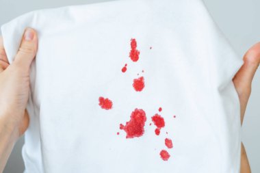 Beyaz kumaşta kirli kan lekesi gösteren kadın elleri. Bozuk giysiler. Temizlik konsepti için kirli leke. Yüksek kalite fotoğraf