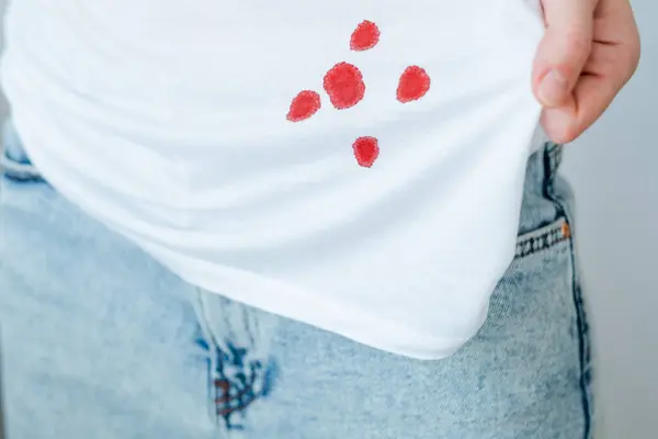 Drops Stain Blood Light Shirt Daily Life Stain Concept Stock Picture