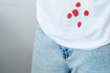 Hafif bir tişörte kan damlatıyor. Günlük yaşam lekesi kavramı. 