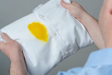 Beklenmedik kazadan kalan beyaz gömlekteki kirli sarı yağ lekesini gösteren eller ve görsel değerlendirme. Günlük yaşam lekesi konsepti. Üst Manzara. Yüksek kalite fotoğraf