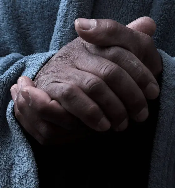 Kesilmiş eller. Adam dua ediyor 