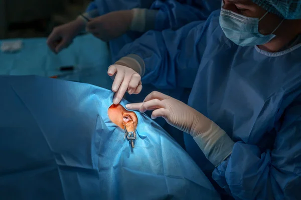 Ženský Doktor Připravuje Operaci Očí Oftalmologická Klinika Mikrochirurgické Optické Zařízení — Stock fotografie