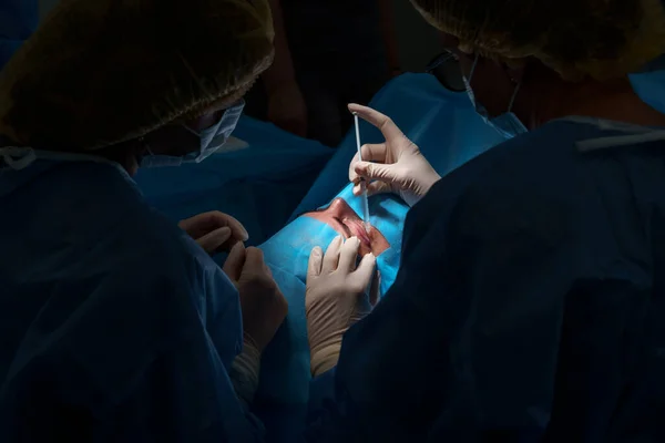 Doktor Právě Provádí Operaci Očí Ženský Chirurg Píchne Injekci Víčka — Stock fotografie