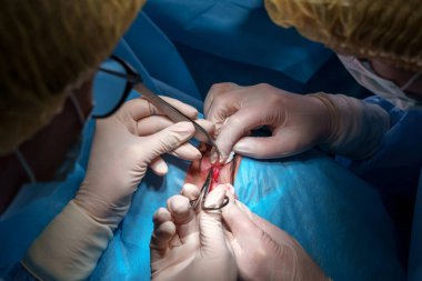 Blepharoplasty plastik cerrahi. Göz çevresindeki bölgenin yenilenmesi ve modifikasyonu. Estetik cerrah ve hemşireler göz kapağı ameliyatı yapıyor.