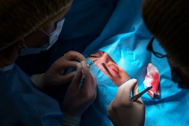 Blepharoplasty plastik cerrahi. Göz çevresindeki bölgenin yenilenmesi ve modifikasyonu. Estetik cerrah ve hemşireler göz kapağı ameliyatı yapıyor.