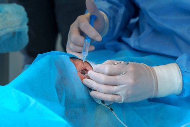 Close-up of surgeon hands carefully administering an injection into the eye during a surgical procedure. Precision instruments and sterile setup ensure safety clipart