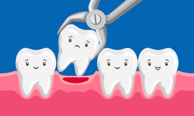 İllüstrasyon diş oral boşlukta forseps tarafından kaldırılır. Çocuk Diş Hekimliği karakterleri. Kawaii yüz ifadeleri.