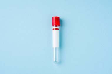 Kırmızı kapaklı ve mavi kapaklı test tüpünün üst görünümü