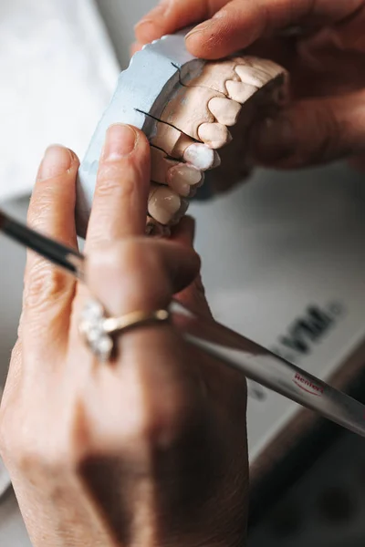 stock image Dental technician modelling ceramic teeth crown