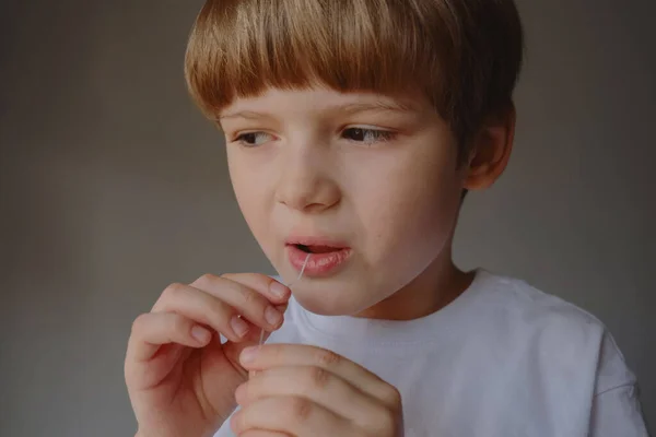 Closeup Portrait Kid Showing His Teeth Cavities Problem —  Fotos de Stock