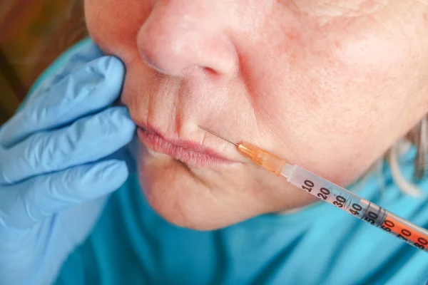 Seniorin Bekommt Spritze Die Lippen Klinik Für Plastische Chirurgie — Stockfoto