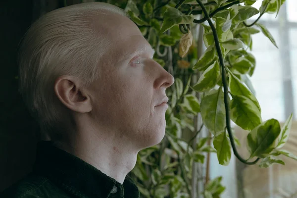 Albino Guy Green Plants Dark Background — Stock Photo, Image
