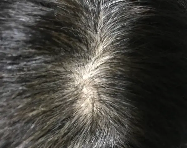 thinning hair and grey hairs in the middle of the woman\'s head in a closeup shot