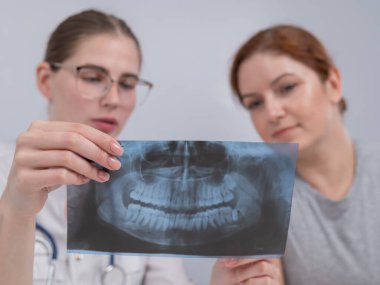 Resepsiyondaki bir kadın doktor ve bir hasta çene röntgenini tartışıyorlar.