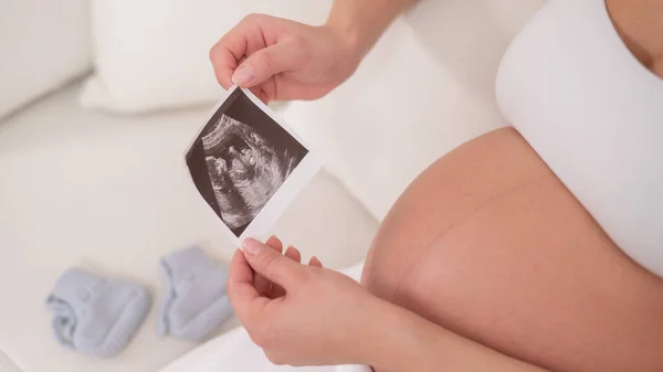 顔のない妊婦は白いソファに座って胎児の超音波写真を保持します — ストック写真
