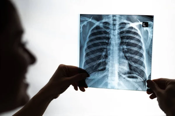 Læge Der Viser Røntgen Patientens Lunger - Stock-foto