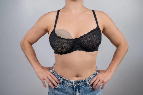Närbild Kvinnas Bröst Behå Kvinna Försöker Med Ett Silikonimplantat Före — Stockfoto