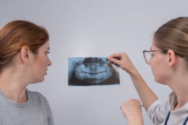 Resepsiyondaki bir kadın doktor ve bir hasta çene röntgenini tartışıyorlar.