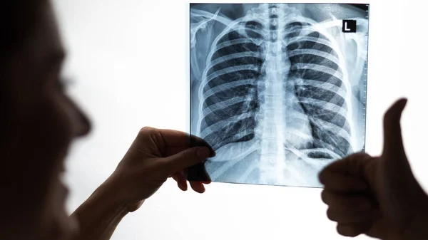 Médico Olha Para Radiografia Dos Pulmões Dos Pacientes Mostra Polegar — Fotografia de Stock