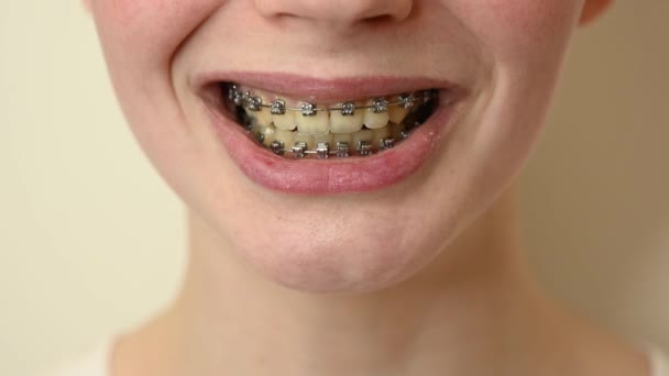 Gros Plan Une Jeune Femme Souriante Pointant Doigt Ses Dents — Video