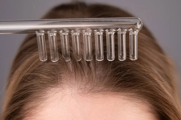 Běloška Česá Vlasy Pomocí Darsonválního Zařízení — Stock fotografie