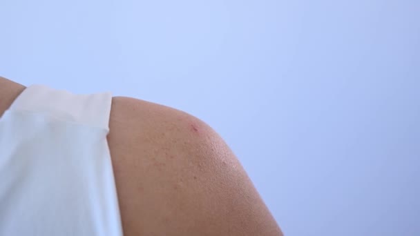 Médico Usa Aparelho Darsonval Contra Acne Ombro Uma Paciente Sexo — Vídeo de Stock