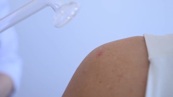 医生用达森器械治疗女病人肩部的痤疮 — 图库视频影像