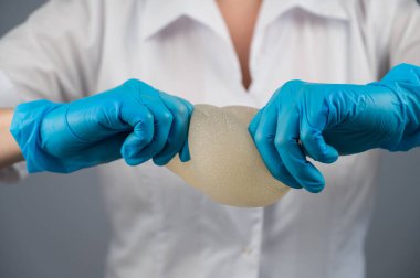 Bir plastik cerrah silikon göğüs implantlarının gücünü onları sıkarak gösterir.