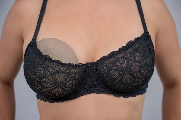 Närbild Kvinnas Bröst Behå Kvinna Försöker Med Ett Silikonimplantat Före — Stockfoto