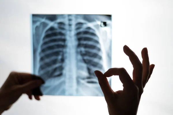 Врач Смотрит Рентген Легких Пациентов Показывает Знак — стоковое фото