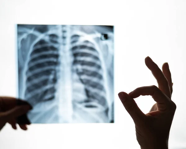 Médico Olha Para Radiografia Dos Pulmões Dos Pacientes Mostra Sinal — Fotografia de Stock