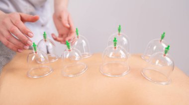 Kadın masaj terapisti hastaların sırtında süpürge kullanıyor.