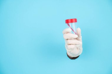 Bir kadın, plastik eldiveni mavi bir kağıttan uzatır ve dışkı toplamak için bir kap tutar.