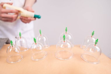 Kadın masaj terapisti hastaların sırtında süpürge kullanıyor.