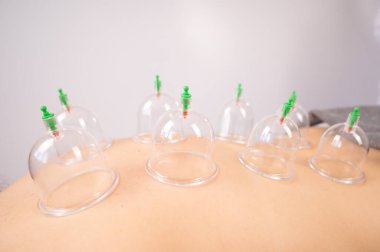 Kadın masaj terapisti hastaların sırtında süpürge kullanıyor.