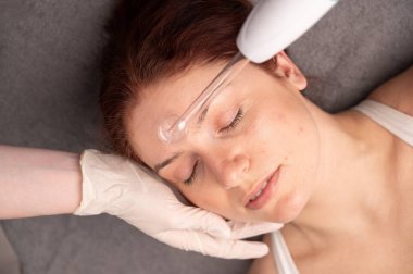 Doktor, kadın bir hastanın yüzündeki sivilce için darsonval aparatı kullanıyor.