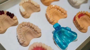 Jaws alçı kalıpları. Protez atölyesindeki çeşitli örnekler