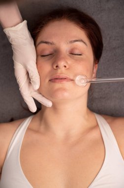 Doktor, kadın bir hastanın yüzündeki sivilce için darsonval aparatı kullanıyor.