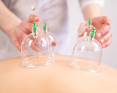 Kadın masaj terapisti hastaların sırtında süpürge kullanıyor.