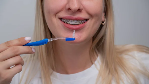 Wanita Kaukasia Membersihkan Giginya Dengan Kawat Gigi Menggunakan Kuas Potret — Stok Foto