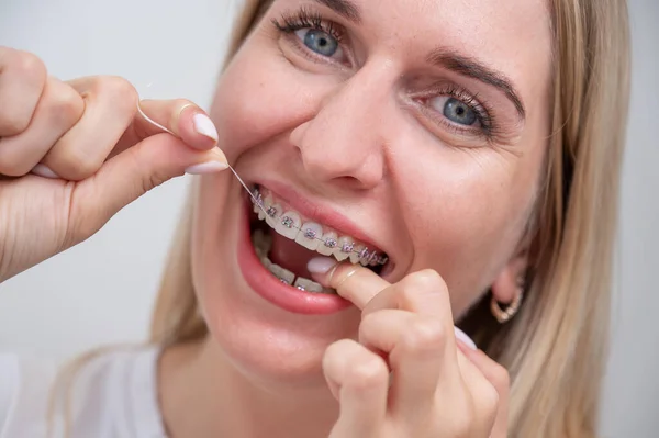 Vit Kvinna Som Rengör Tänderna Med Tandställning Med Tandtråd — Stockfoto
